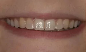 Dentist Davidson