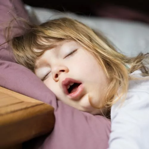 Sleep Disordered Breathing Image