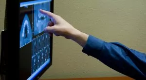 digital xray