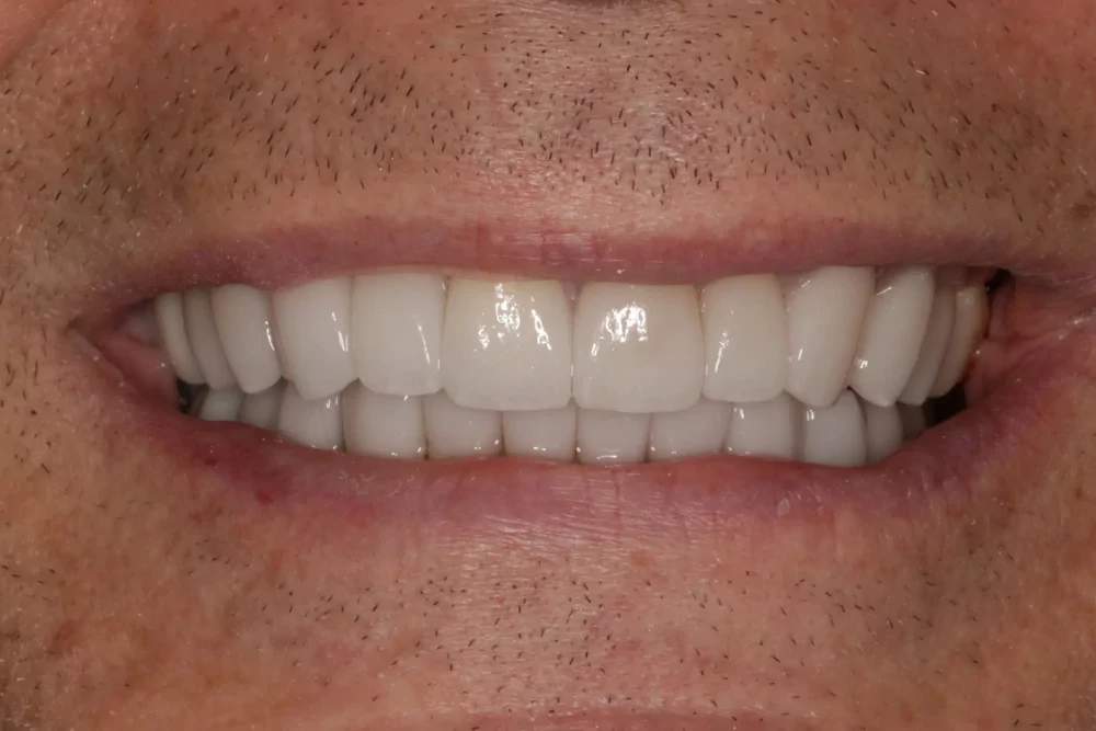 Rick After