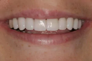 Dentist Davidson