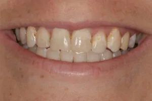 Dentist Davidson